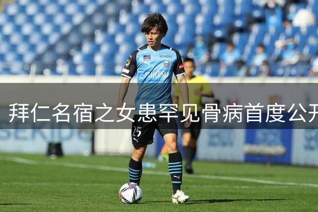 拜仁名宿之女患罕见骨病首度公开心路历程 舞台骨折经历令人揪心